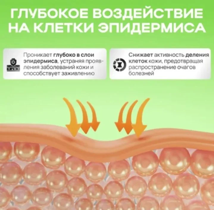 Мазь от псориаза - миниатюра 4