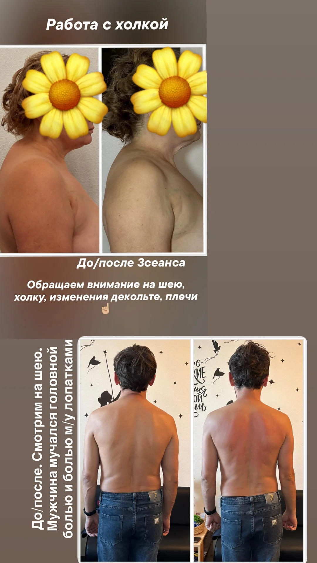 Миофасциальный массаж, мадератерапия - миниатюра 10