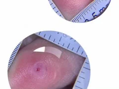 Подолог с медицинским образованием - миниатюра 12