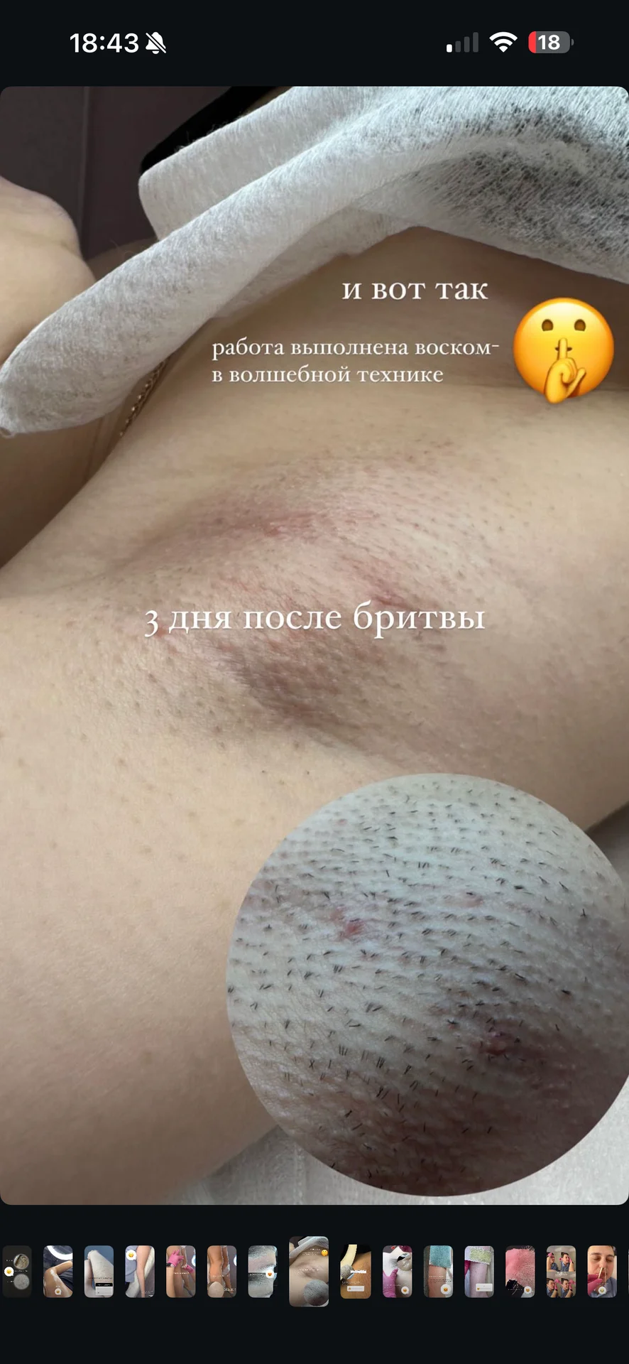 Лазерная эпиляция Шугаринг Обучение Ростов-на-Дону - миниатюра 9