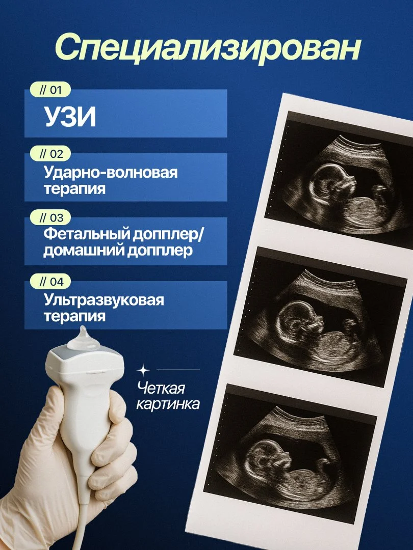 Гель для УЗИ ЛЕОНМЕД, средней вязкости (5 литров) - миниатюра 2