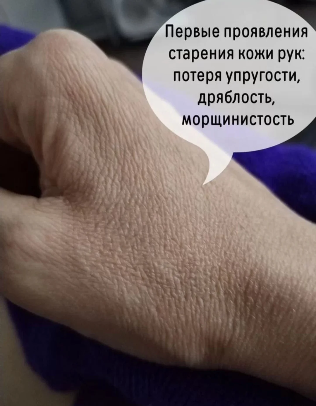 Омоложение без уколов - миниатюра 3