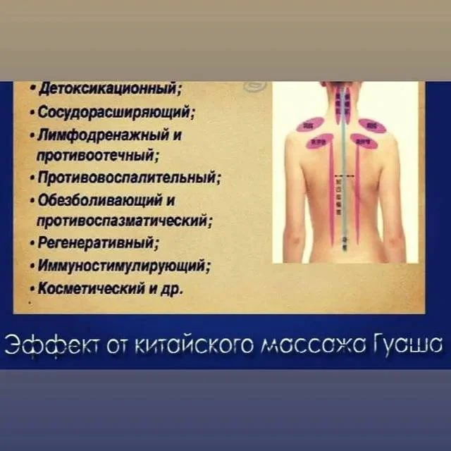 Китайский массаж ГУА ША - миниатюра 4