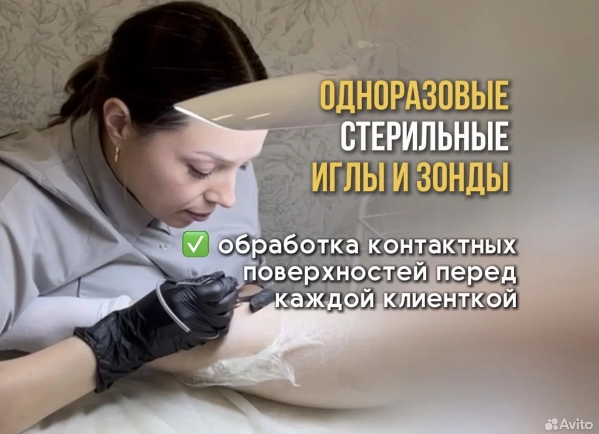 Электроэпиляция - миниатюра 7