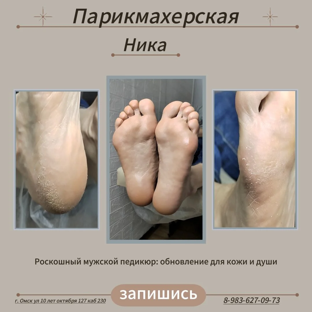 Педикюр Smart - миниатюра 4