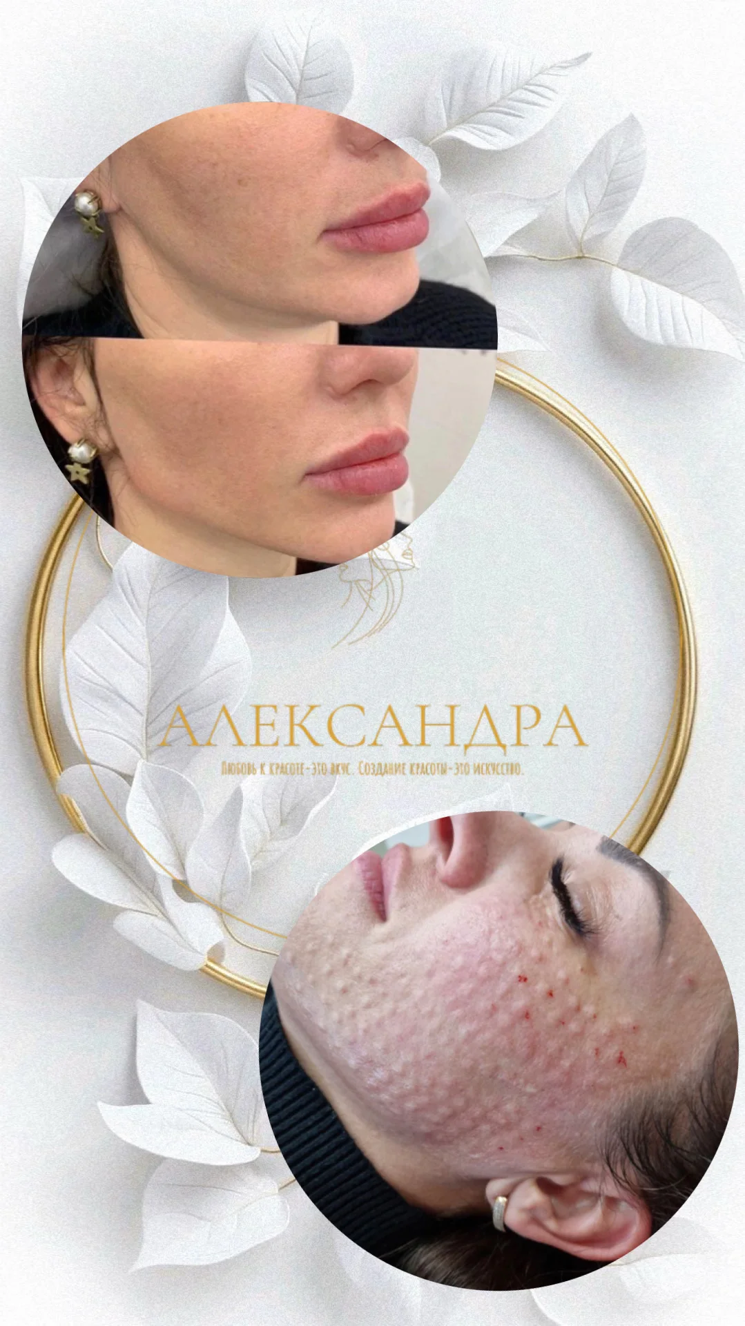 Примерка губ 14 дней/ Косметолог / Загар /Обучение - миниатюра 5