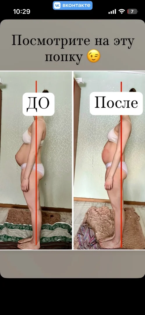 Послеродовые правки - миниатюра 2