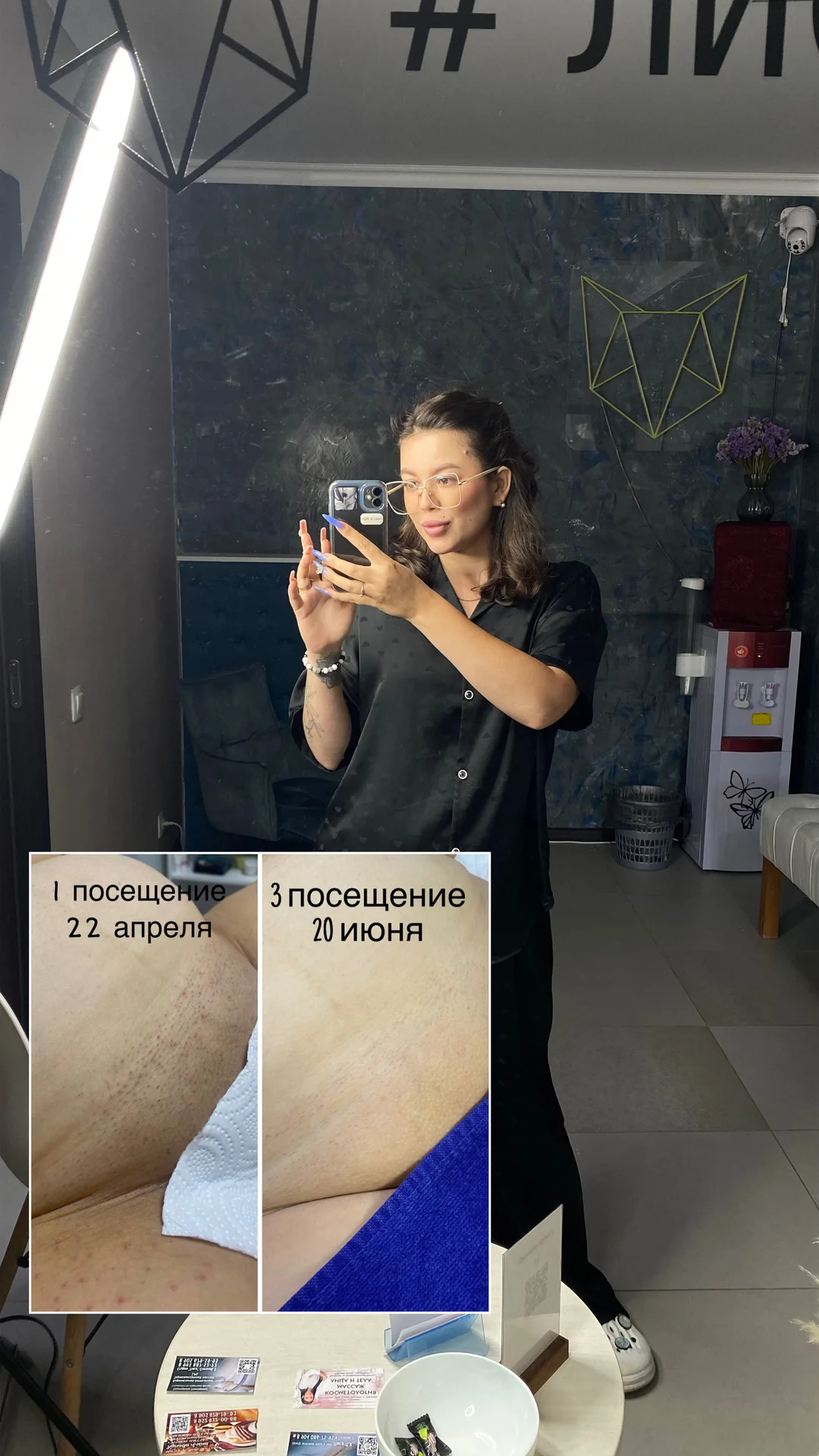 Обучение лазерной эпиляции - миниатюра 4