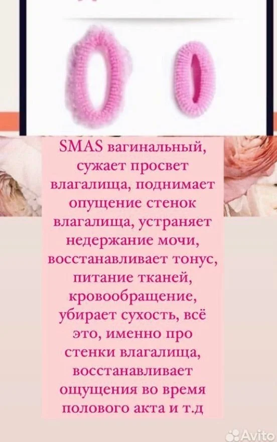 SMAS лифтинг СМАС - миниатюра 15