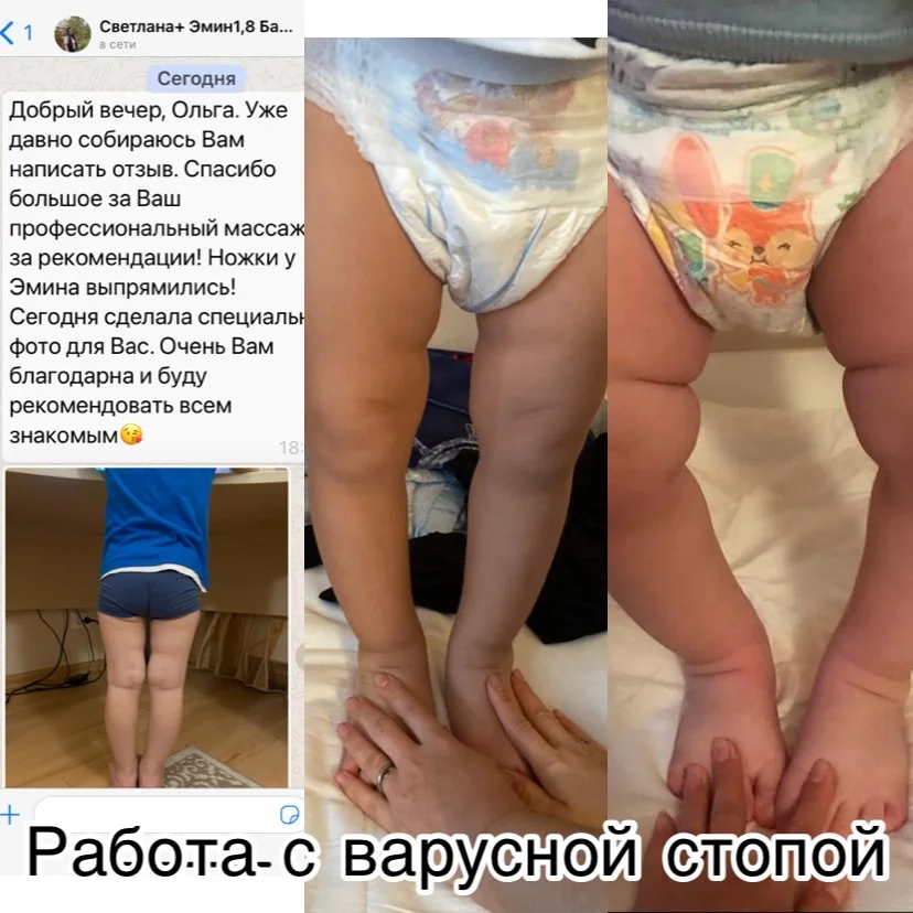 Детский массаж, гимнастика, ЛФК, фитбол - миниатюра 3