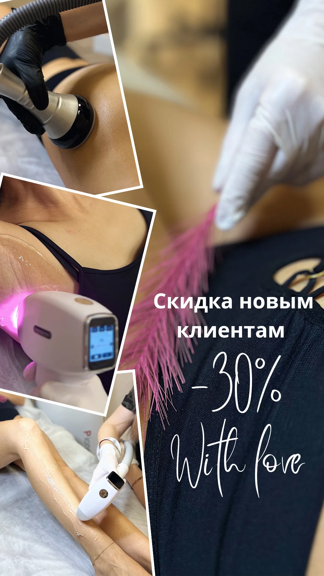 Лазерная эпиляция - миниатюра 5