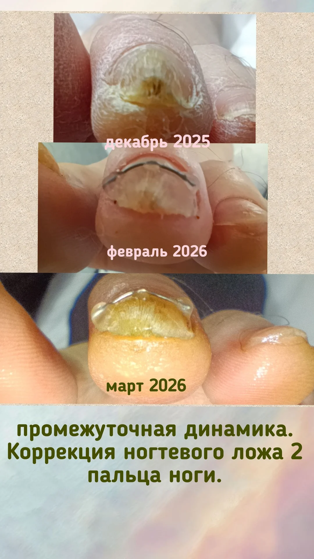 Подолог для пожилого человека с выездом  на дом - миниатюра 8