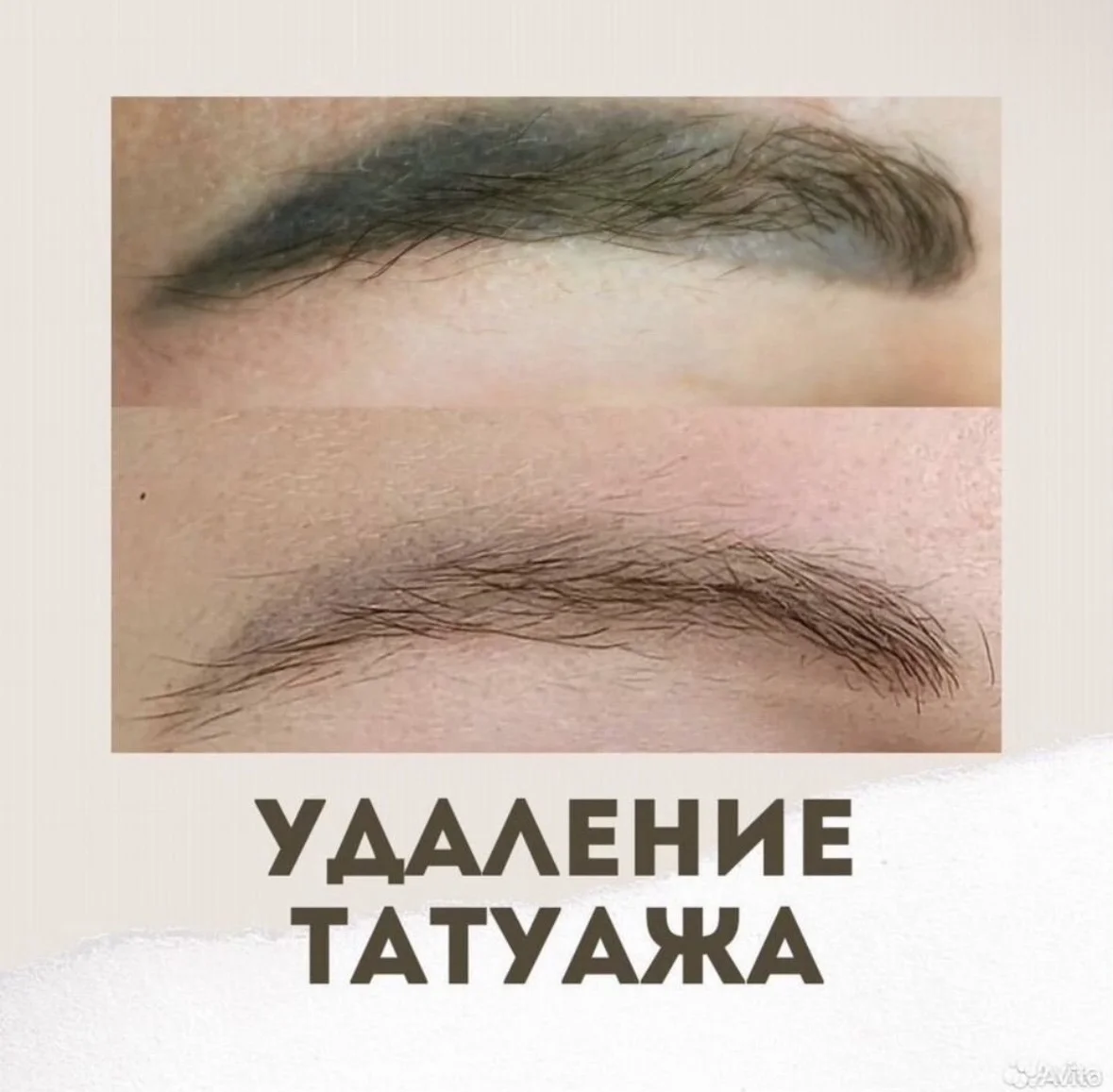 Ламинирование ресниц и бровей. Удаление татуажа - миниатюра 8
