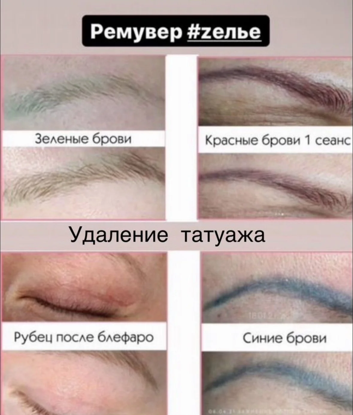 Ламинирование ресниц и бровей. Удаление татуажа - миниатюра 9