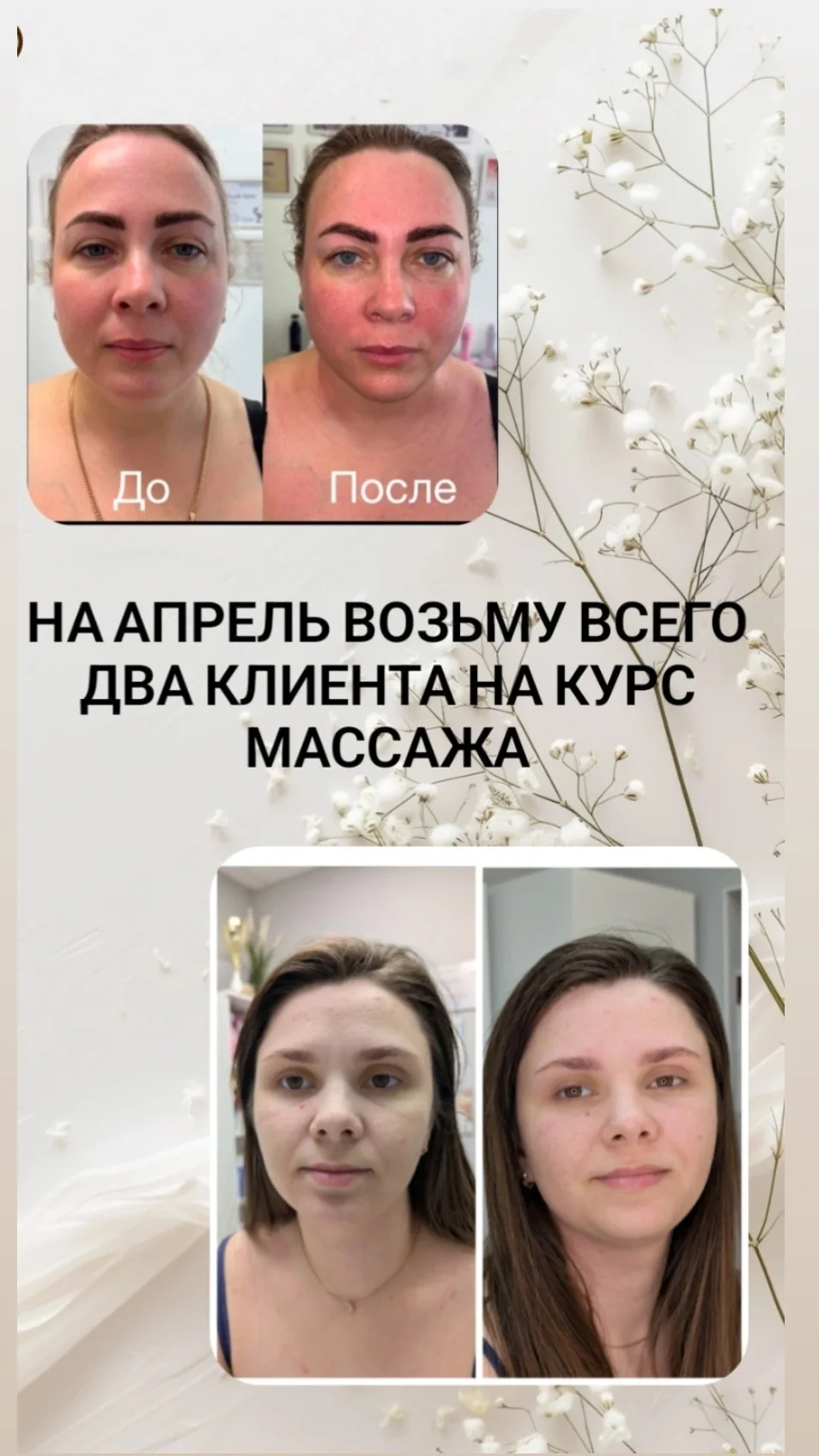 Скульптурно-мануальный массаж лица - миниатюра 6