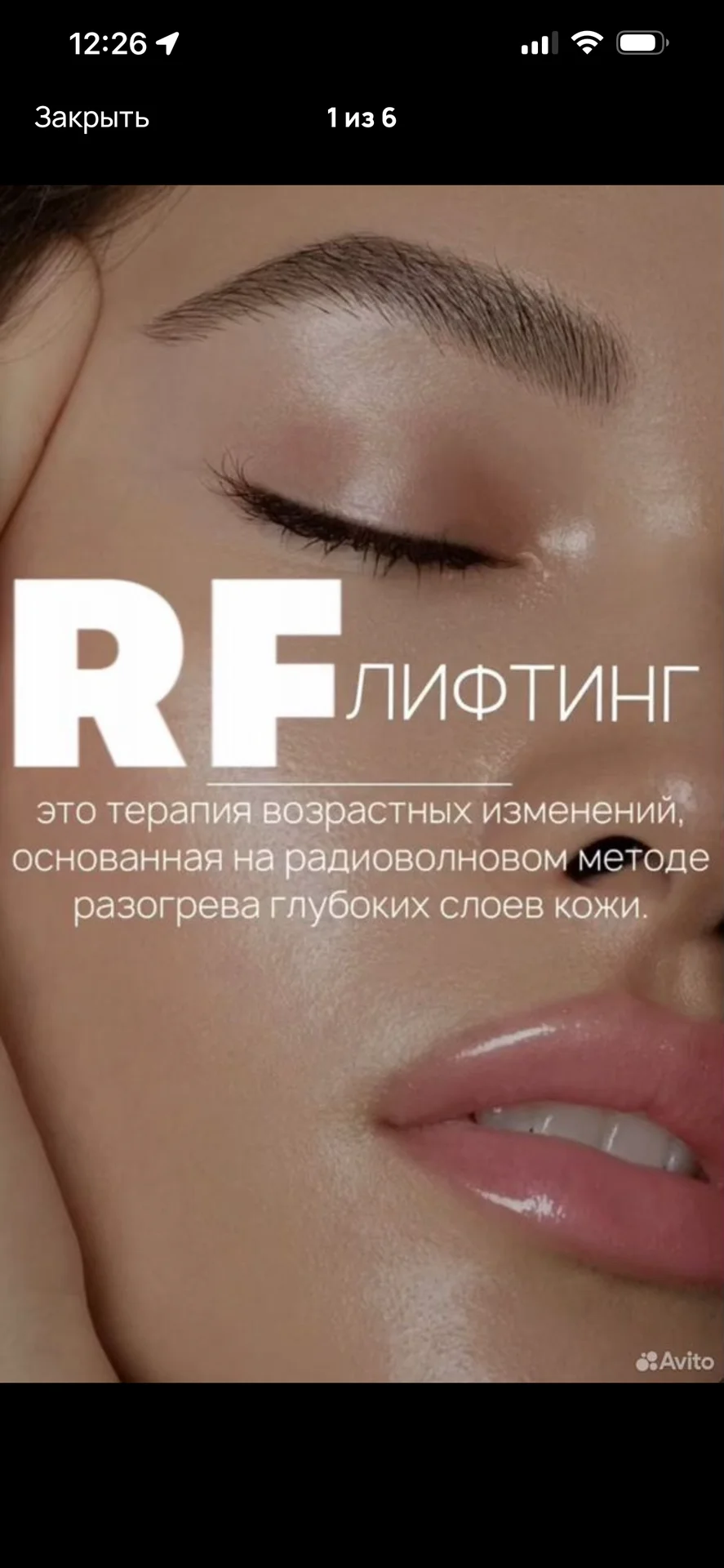 RF лифтинг - изображение 1