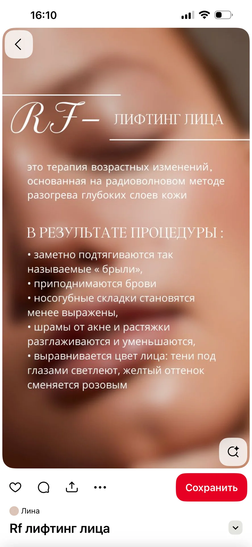 RF лифтинг - миниатюра 2