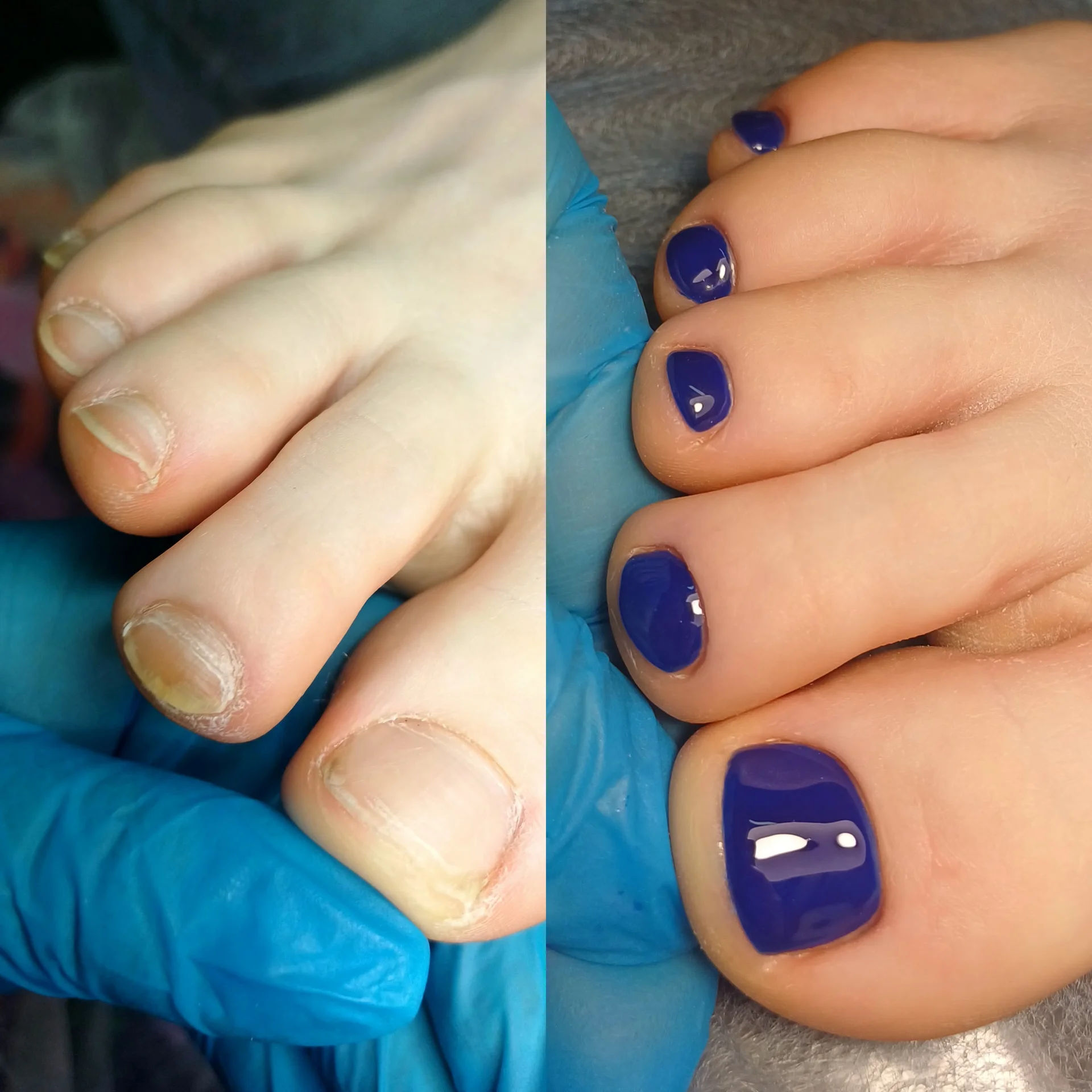 💅 Маникюр,педикюр,наращивание ногтей, лами - миниатюра 14