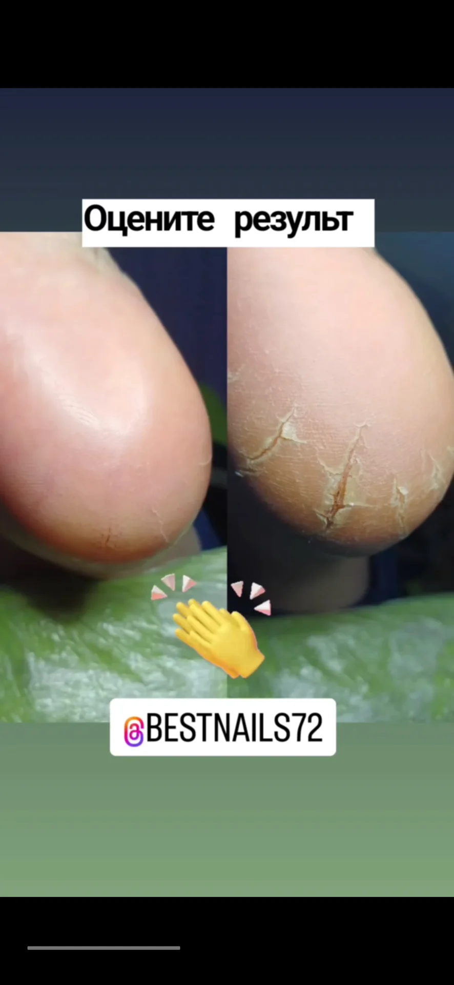 💅 Маникюр,педикюр,наращивание ногтей, лами - миниатюра 16