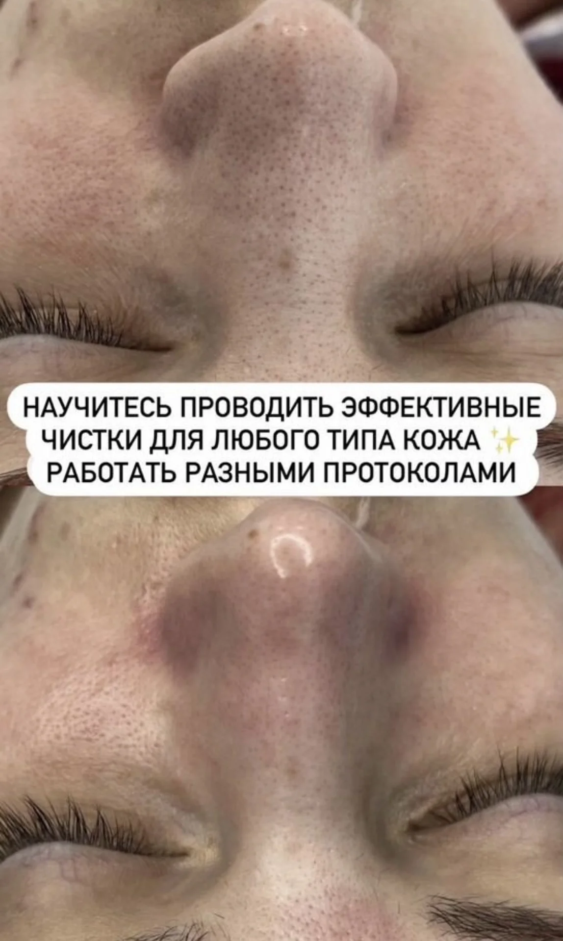 Обучение косметологов, курсы косметолога - миниатюра 5