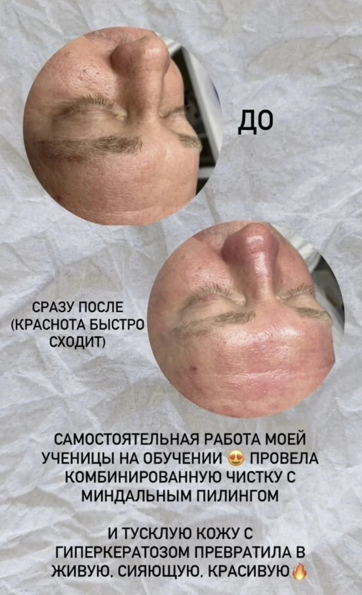 Обучение косметологов, курсы косметолога - миниатюра 7