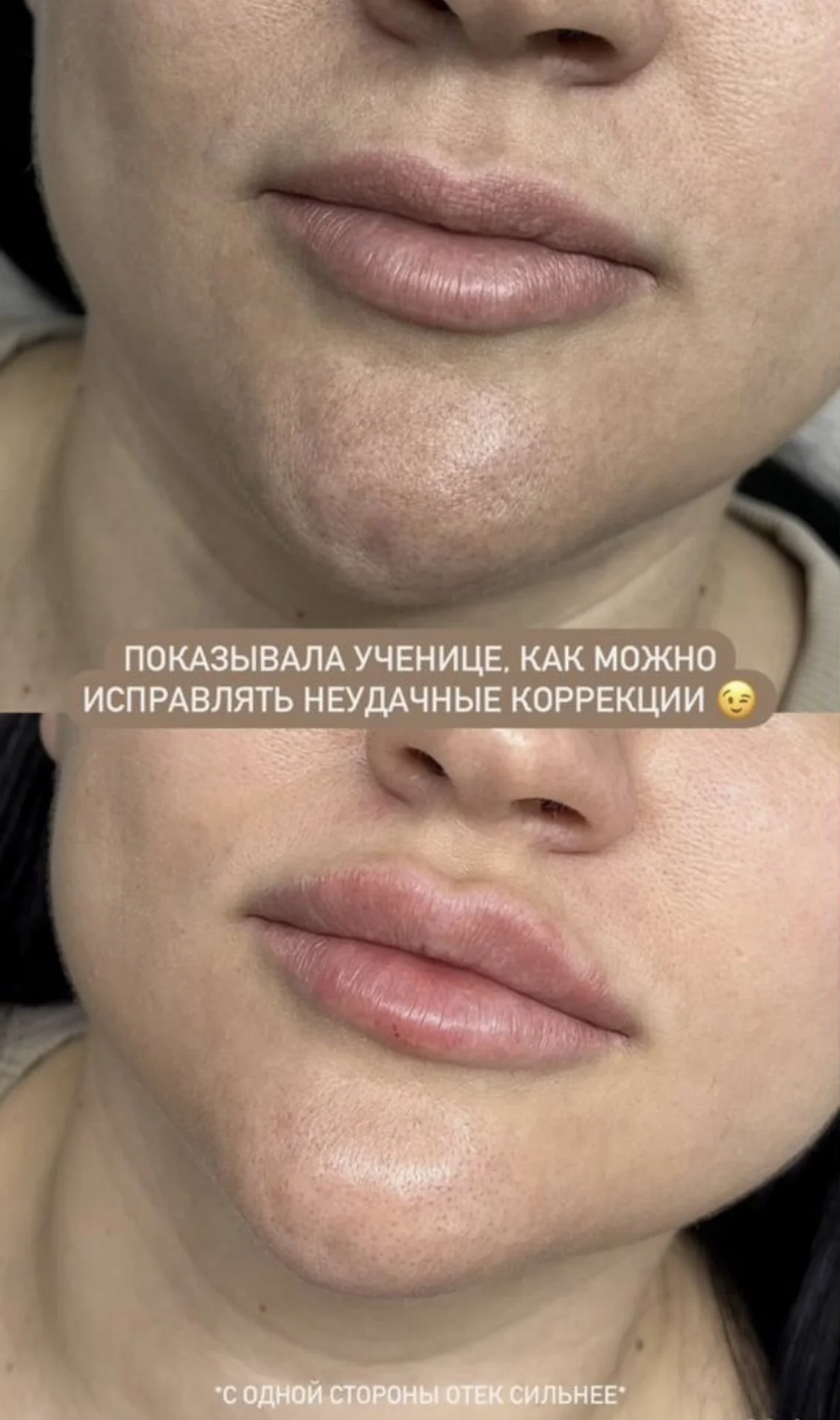 Обучение косметологов, курсы косметолога - миниатюра 10