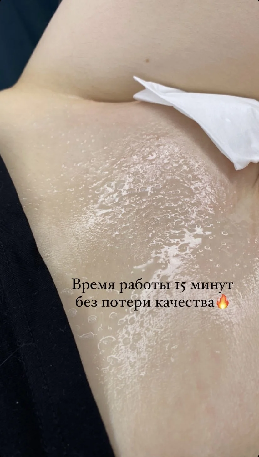 Депиляция - миниатюра 2