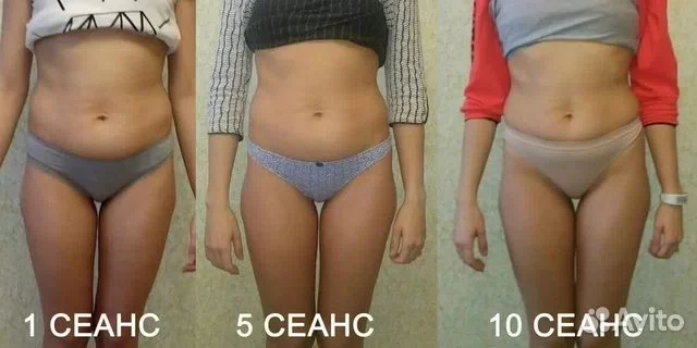 Массаж классический, антицеллюлитный, мануальный - миниатюра 2