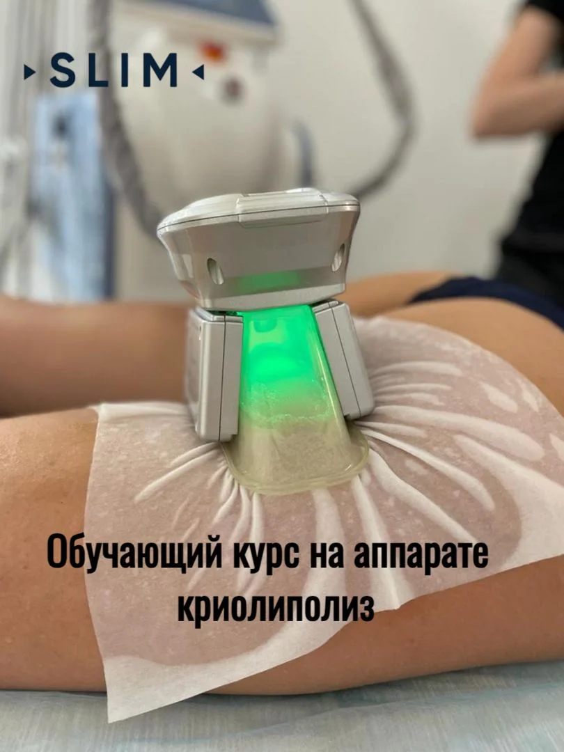 Обучение криолиполизу - миниатюра 2