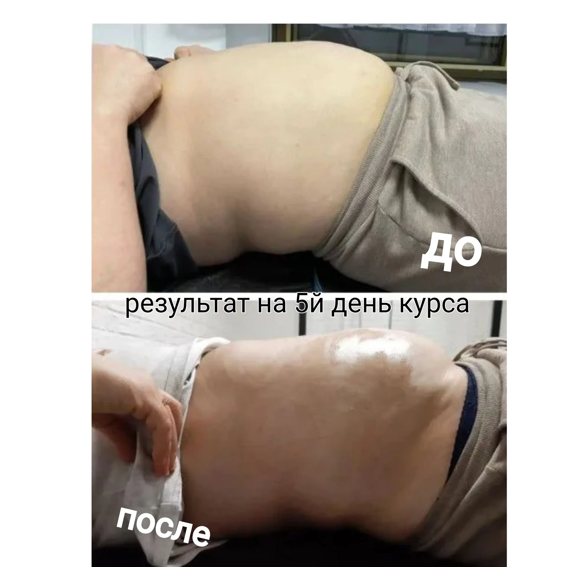 Массаж - миниатюра 5