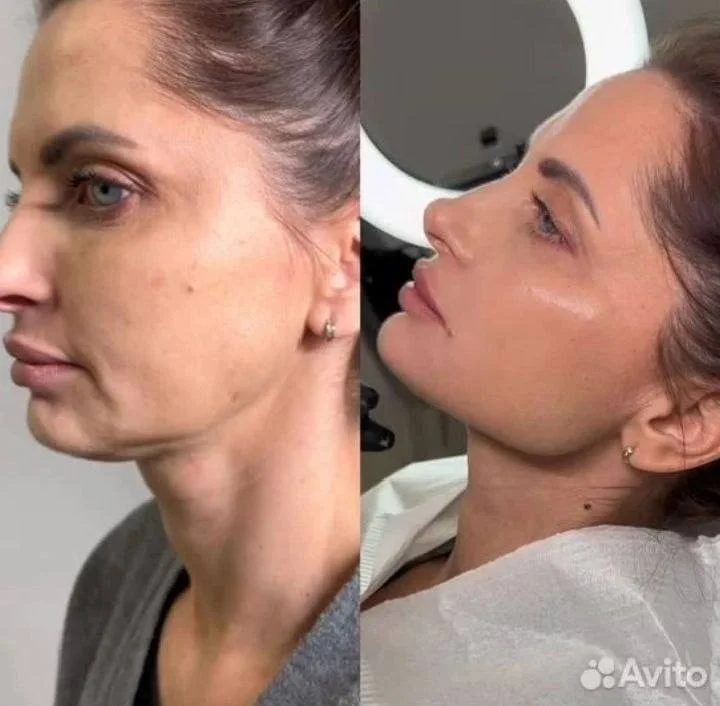Эстетическая косметология - миниатюра 10