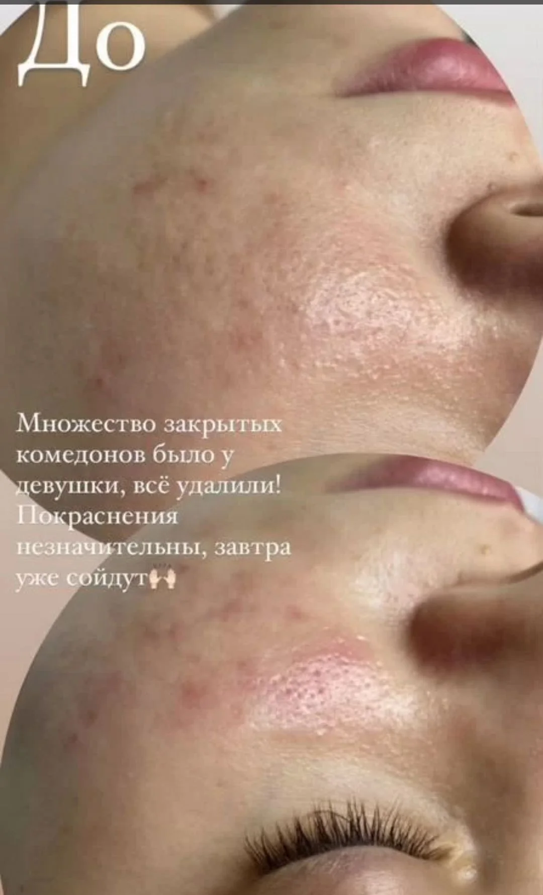 Косметолог Эстетист уход за лицом - миниатюра 2