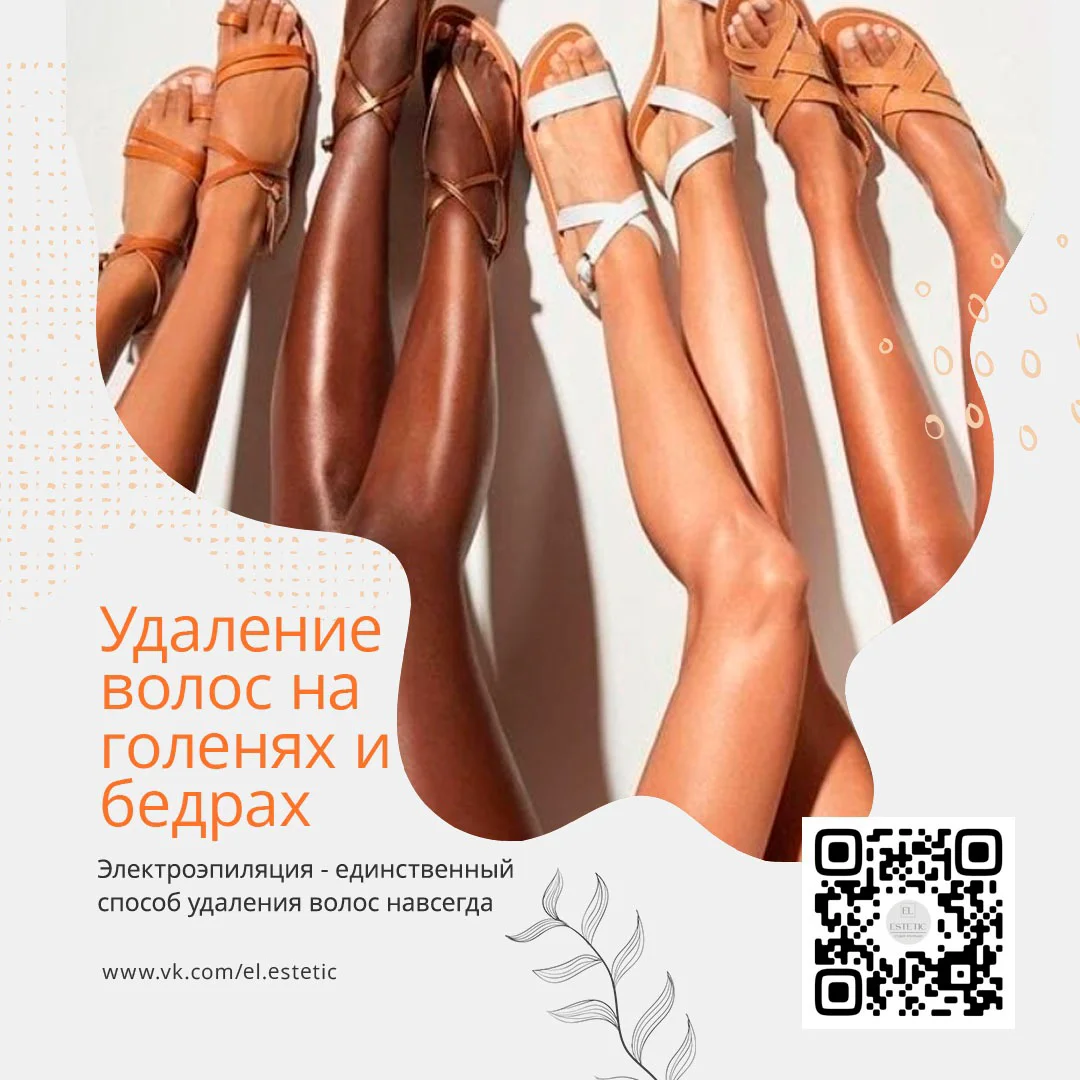 Электроэпиляция - ноги 1 час - изображение 1