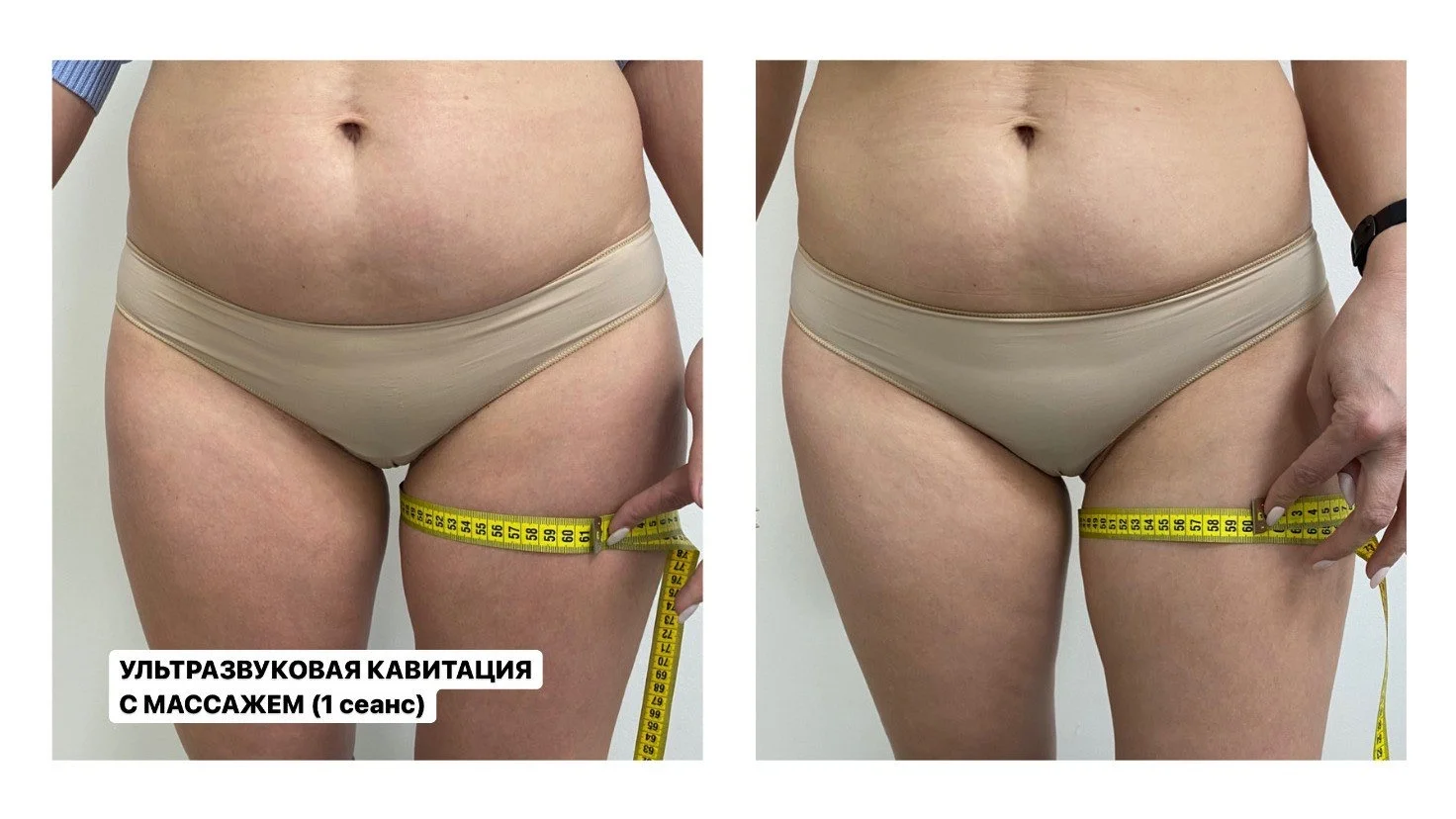 Коррекция фигуры, подтяжка лица и тела, массаж - миниатюра 7