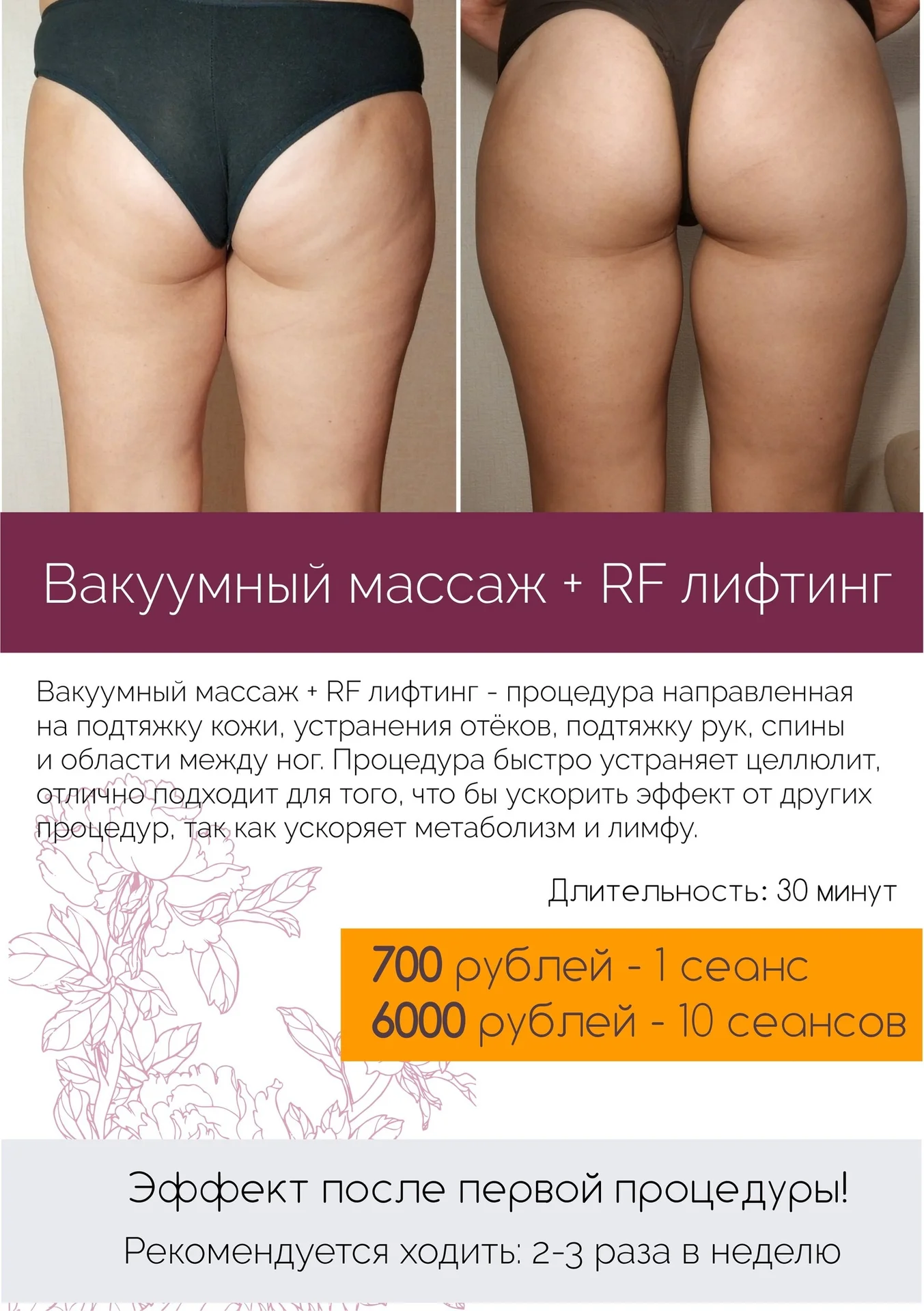 Коррекция фигуры, подтяжка лица и тела, массаж - миниатюра 11