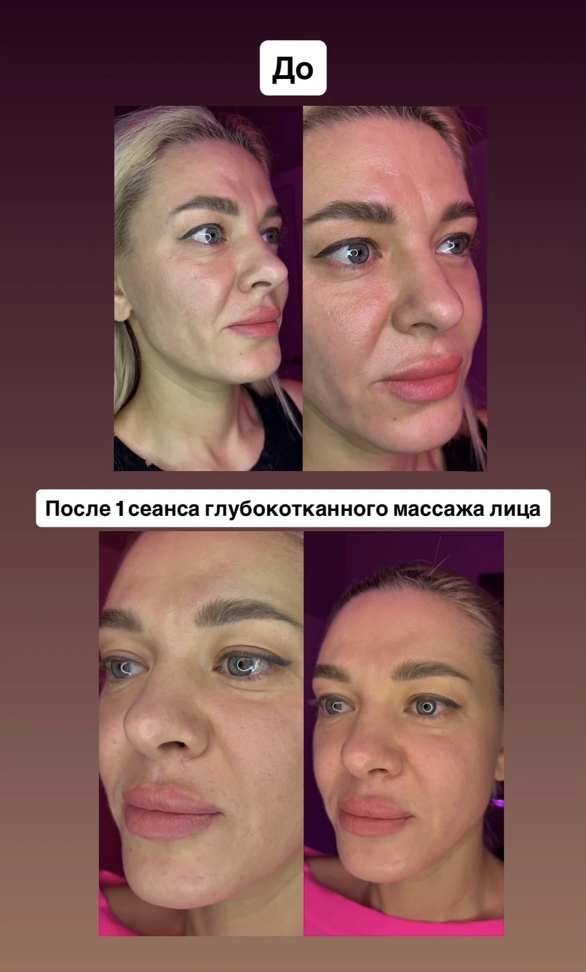 Глубокотканный массаж лица | моделирование лица - изображение 1