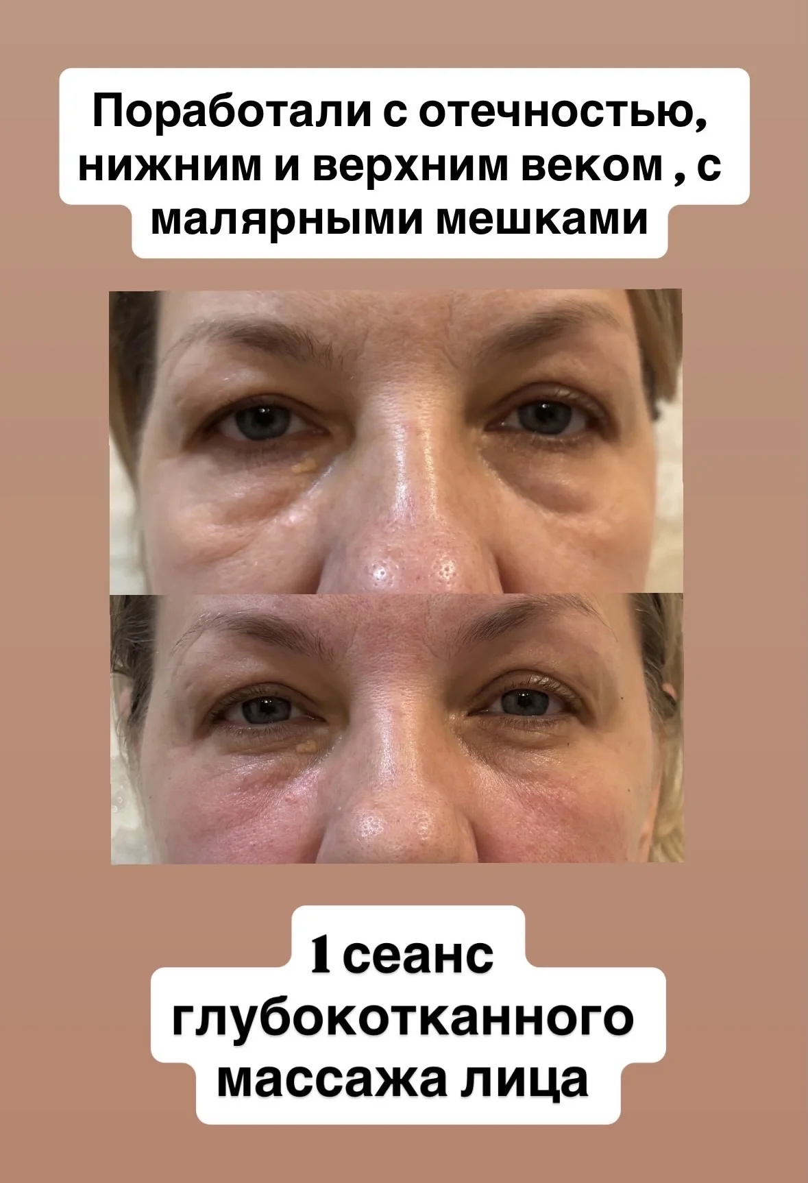 Глубокотканный массаж лица | моделирование лица - миниатюра 2