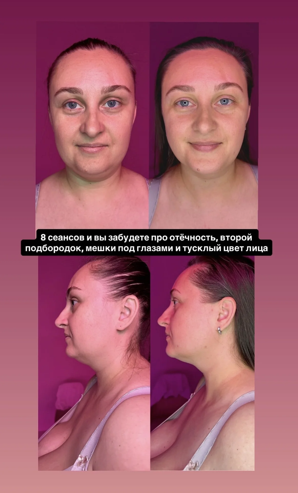 Глубокотканный массаж лица | моделирование лица - миниатюра 7