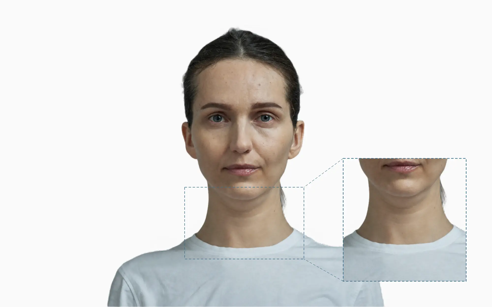 Woman's chin and neck with a magnified callout showing a double chin