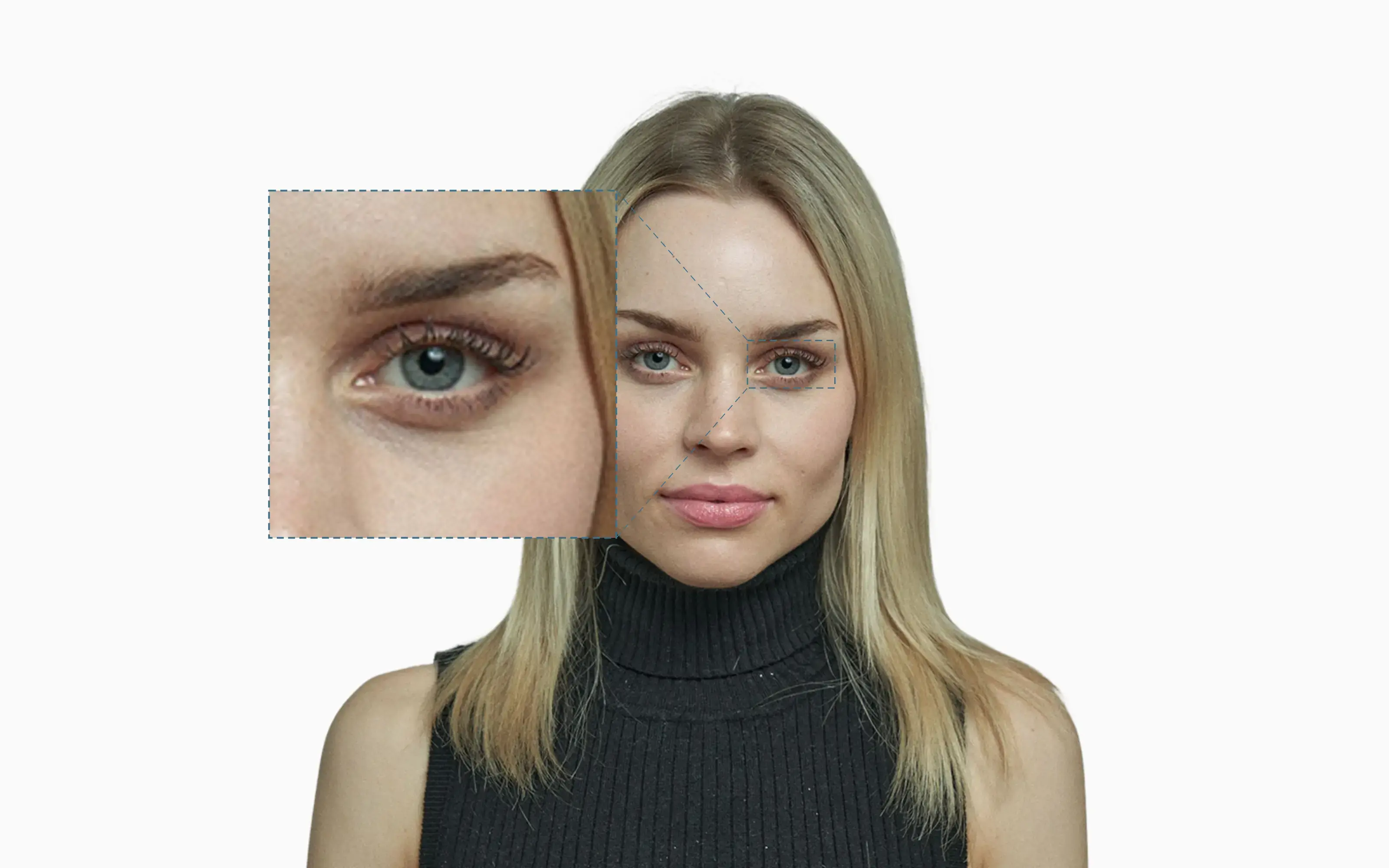 Under-eye dark-circle region on a frontal face