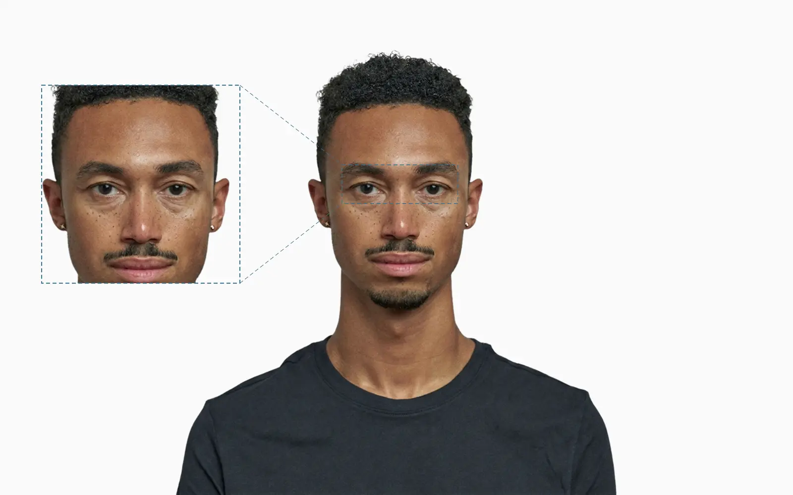 Hooded eyes on a frontal face, with the upper-eyelid area shown in an adjacent zoom panel