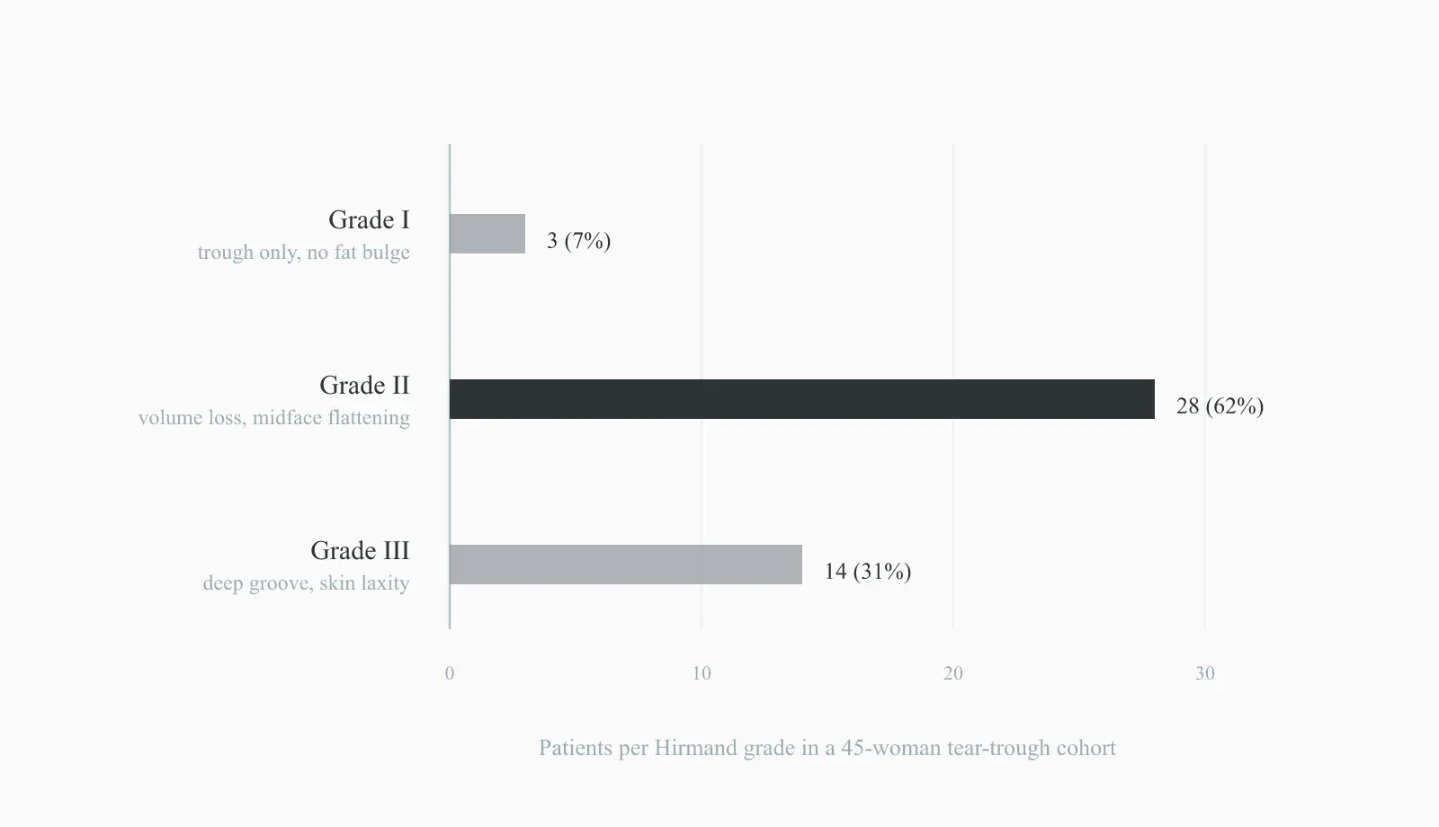 Hirmand grade distribution of tear troughs in 45 patients, Grade II most common