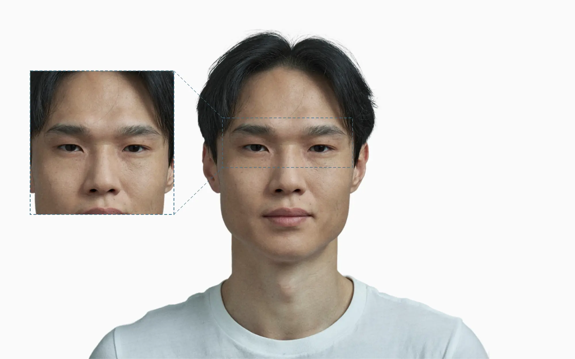 Frown lines between the eyebrows on a portrait with a magnified glabella callout
