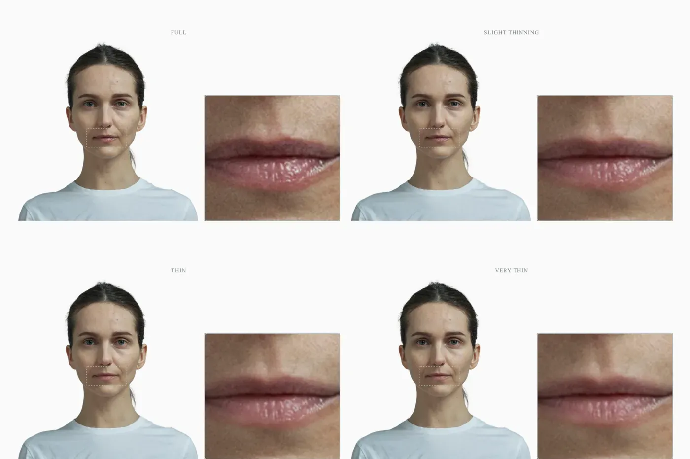 Lips thinning across four stages, full to very thin, on one unchanged face
