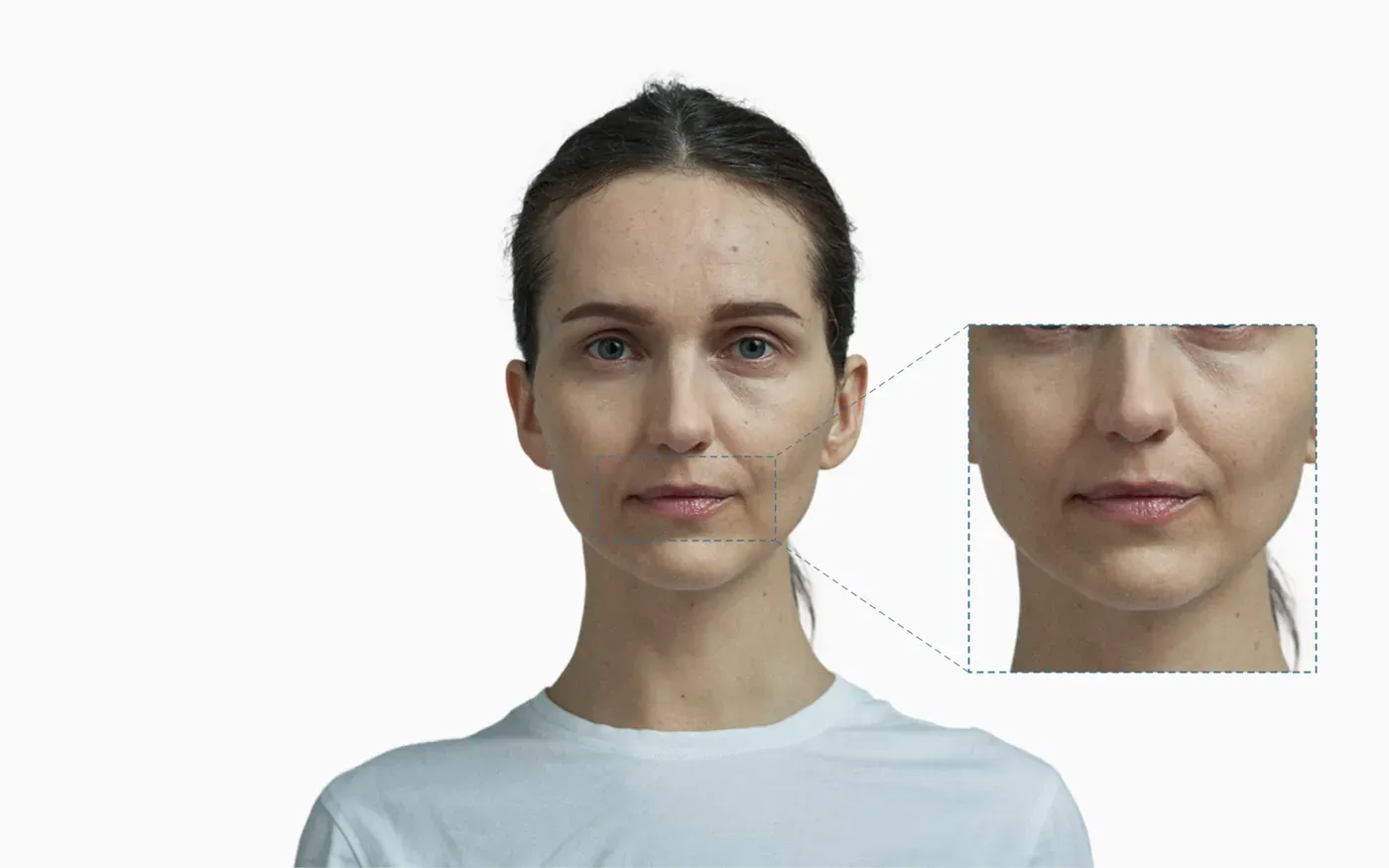 Thin lips on a front-facing portrait, with a dashed callout magnifying the mouth