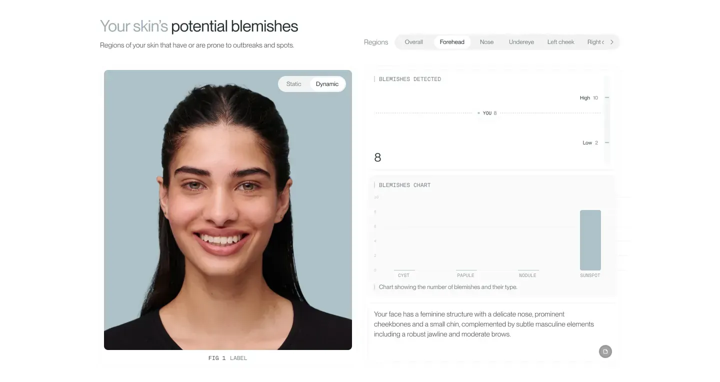 FASEVA blemish analysis card with a skin score and detected blemishes mapped across facial regions