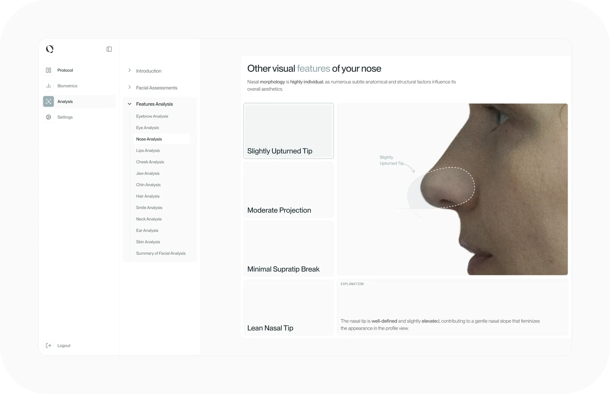 faseva-vs-rekognition-1.webp
