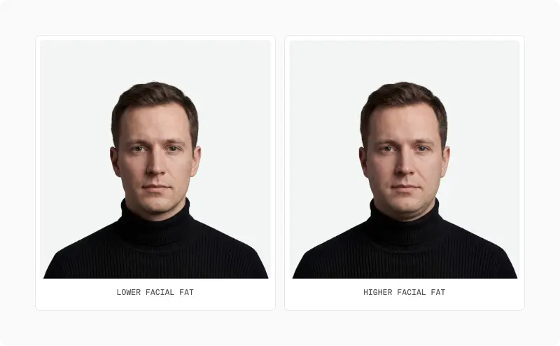 Two front portraits of the same man labelled lower facial fat and higher facial fat