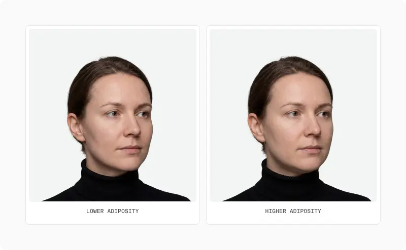 Two front portraits of a woman from a three-quarter angle, labelled lower adiposity and higher adiposity