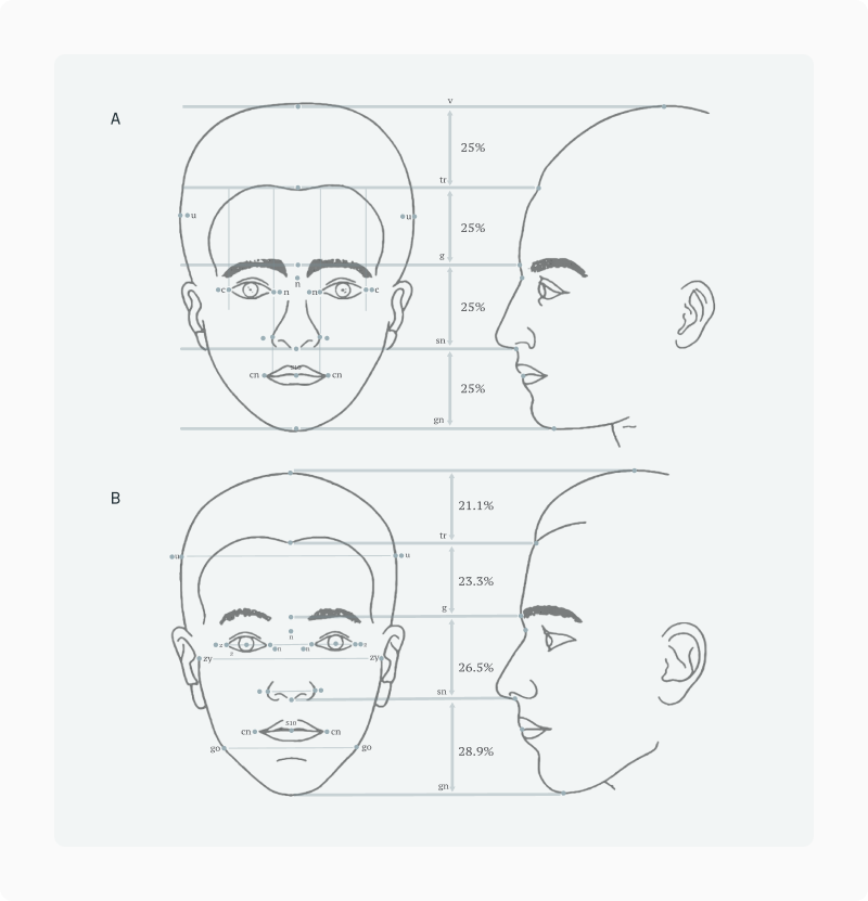Side-by-side front and profile head diagrams comparing the Neoclassical canon (equal quarters) with Farkas' measured proportions